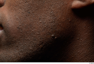  HD Face skin references Deqavious Reese cheek skin pores skin texture 0006.jpg